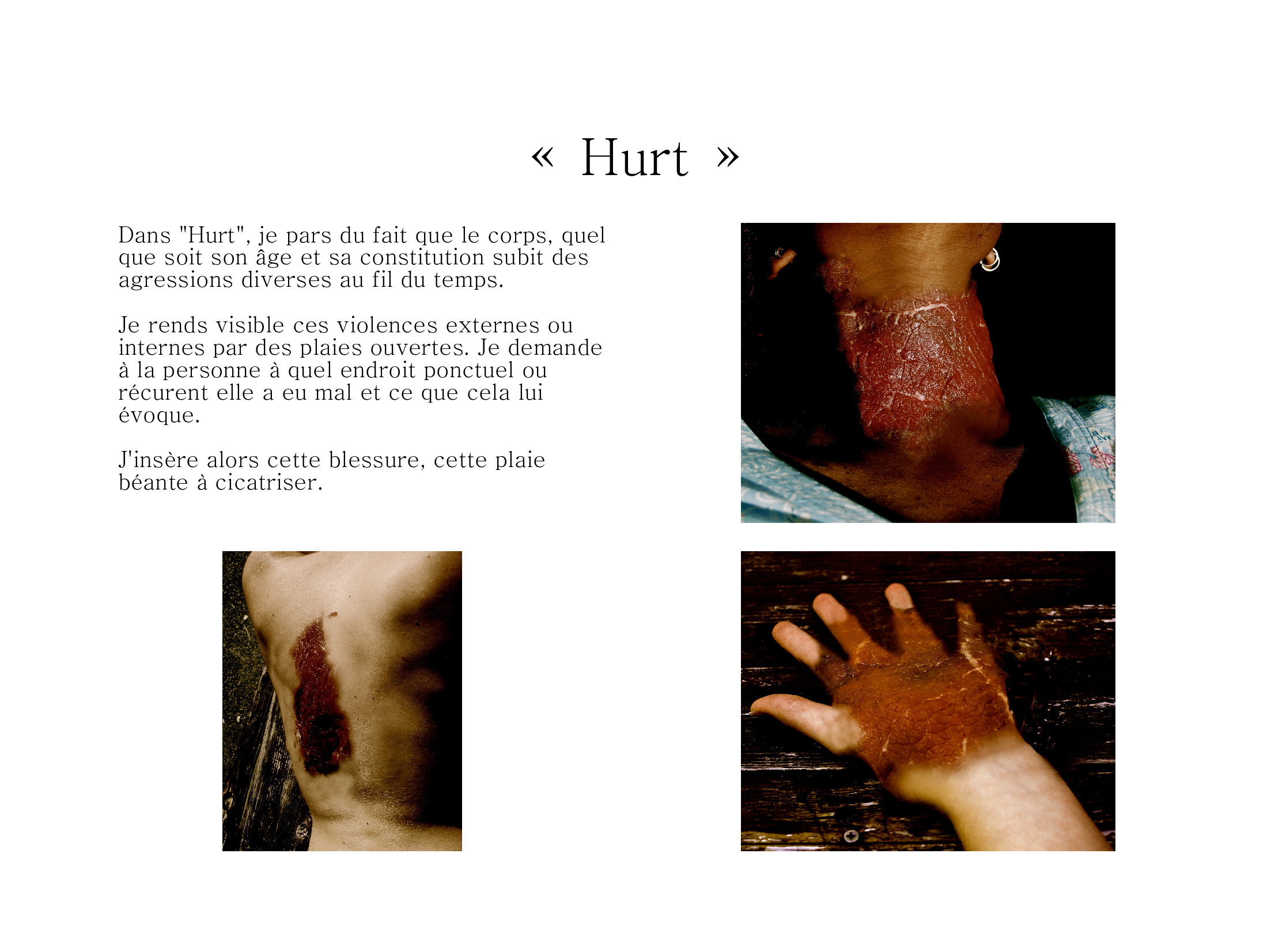hurt
By S.M.Art